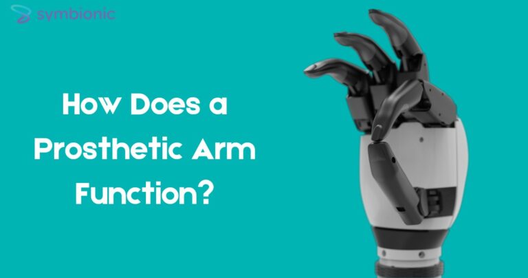 prosthetic arm