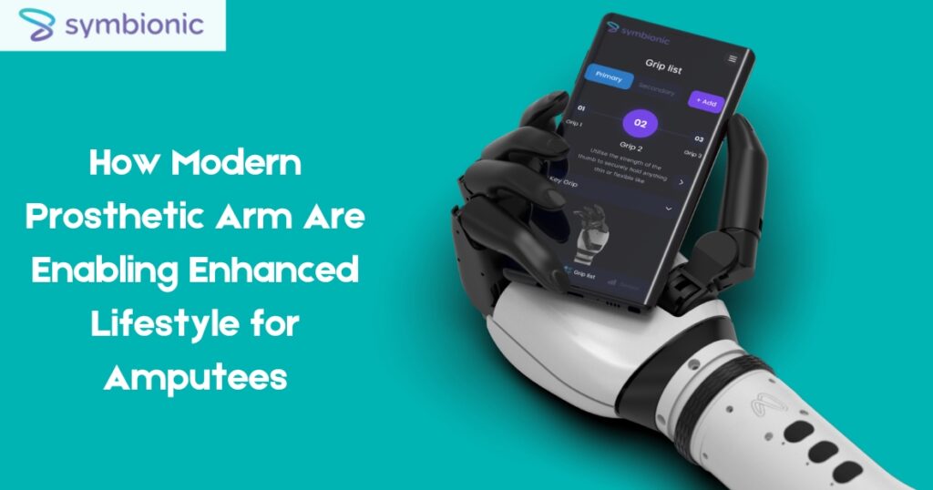 modern prosthetic arm